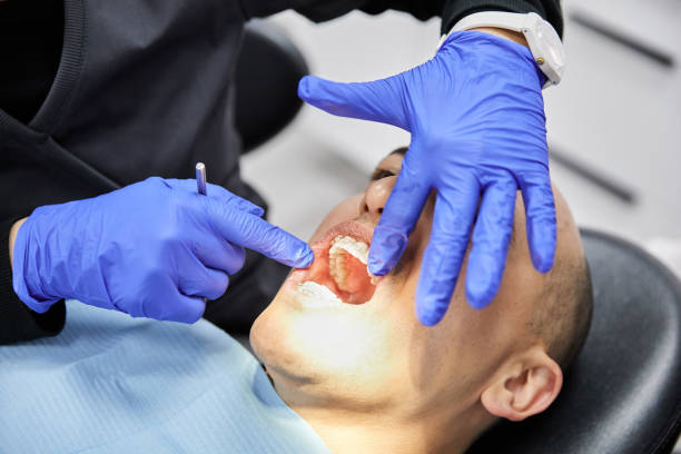 Best Emergency Treatment for Dental Infections or Abscesses in Maplewood, MO